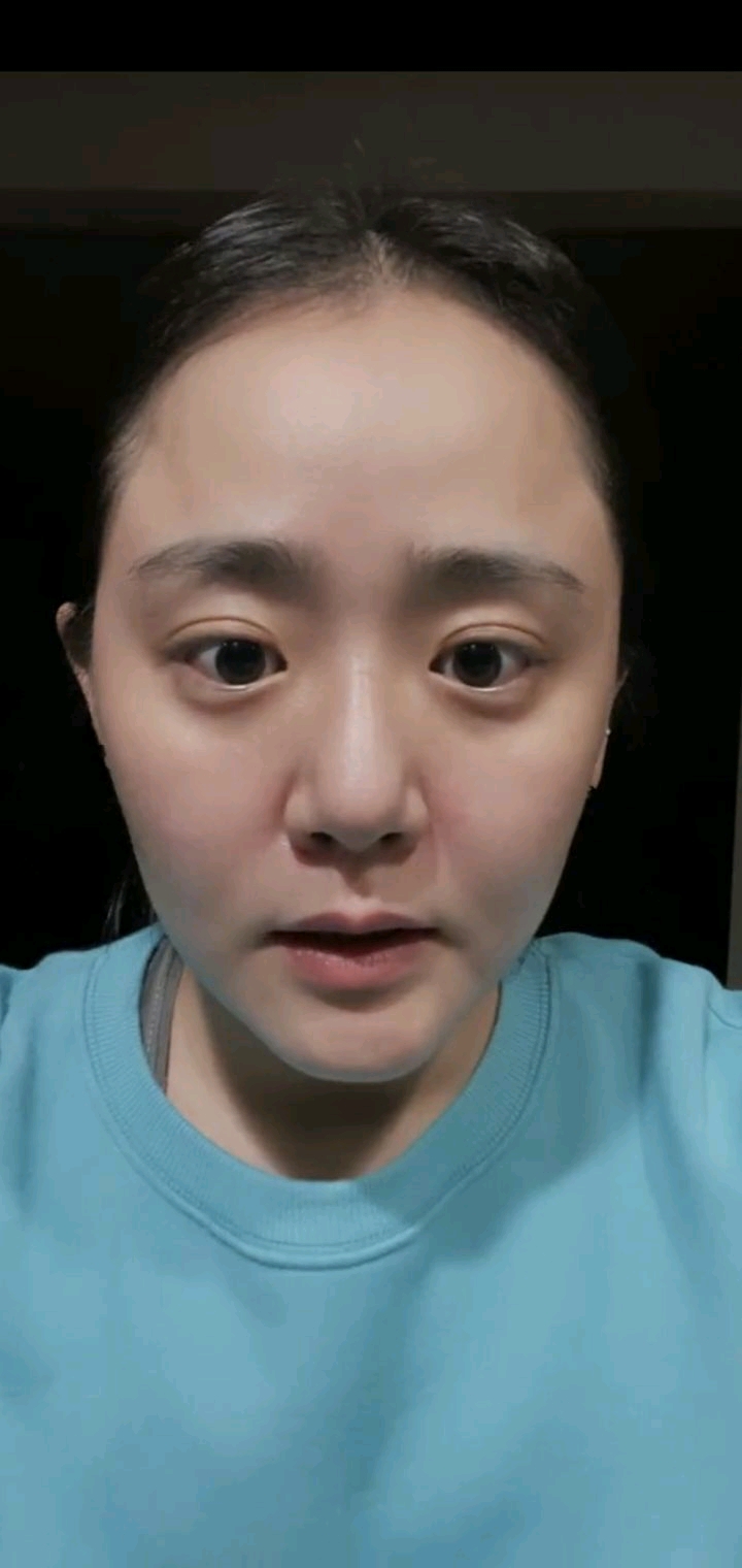《藍色生死戀》文根英直播，生病差點截肢的韓國國民妹妹也34歲了